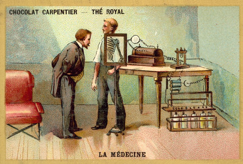 Patient som har en röntgen (chromolitho) av French School