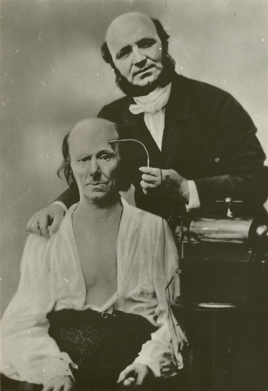 Den franske neurologen Duchenne de Boulogne använder sin elektrofysiologiska apparat på en gammal man av Guillaume Benjamin Armand Duchenne de Boulogne