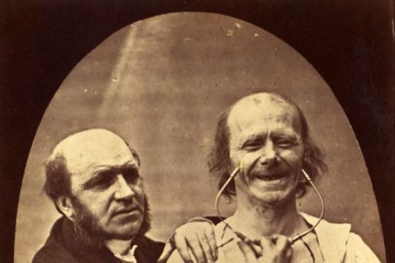 Guillaume Benjamin Duchenne