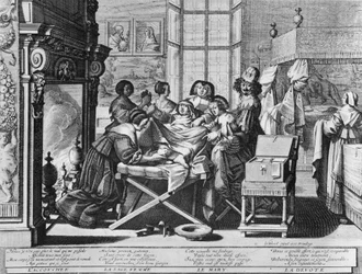 Gravyrserie (water forte) med titeln "" Äktenskapet med staden""" från 1633 av Abraham Bosse - "" Förlossning"": på arbetsbädden.