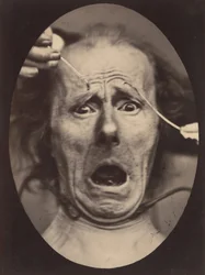 Electro-Physiologie, figur 64, 1854-56, tryckt 1862.