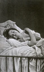 Ung kvinna med ett anfall av hysteri, 1878