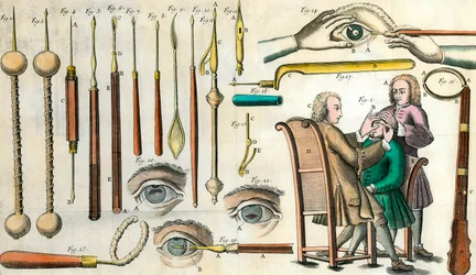 Kirurgi på 1700-talet: ögonoperation. Instrument för kataraktoperation och konstgjord pupillbildning. Gravyr i "Institutions chirurgicale" av Lorenz Heister