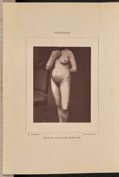 Generaliserad vesikulär syfilis