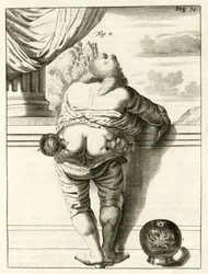 Ett exempel på koppning, från The Practice of Medicine av Frederik Dekkers, 1694