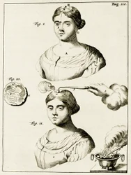 Behandling av en lidande av epilepsi, från Exercises in the Practice of Medicine av Frederik Dekkers, 1694