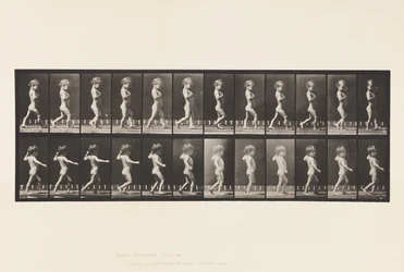 Plåt 540.A, Bow Ben; Pojke; B, Spinal karies; Flickan går, 1885