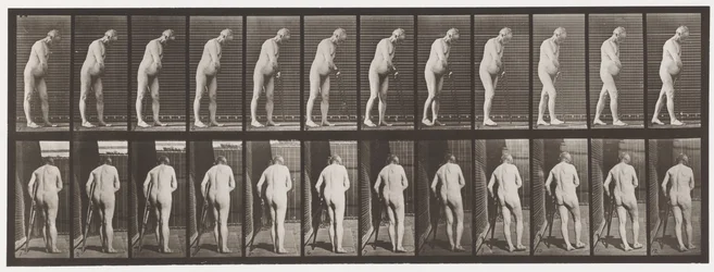 Tallrik 547.Hemiplegi; Walking with Crutch, 1885
