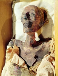 Mumifierad kropp av Ramses II (1304-1237 f.Kr.) hittades i en grav i Deir al-Bahri