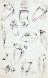 Metoder för att arrestera blödning, c.1890
