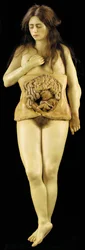 Anatomisk modell av en äggstocksgraviditet