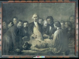 The Anatomy Lesson of Doctor Velpeau (1795-1867) (kol på papper lagt på duk)