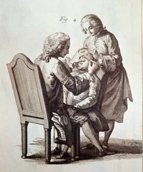 En läkare som opererar en patient med grå starr, illustration från Medical Encyclopedia av Denis Diderot och Jean le Rond d