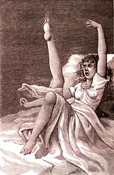 Hysteri, ett extremt mentalt fenomen, psykoser och psykoneuros.1887 (gravyr)