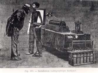 Radiguet röntgenapparat