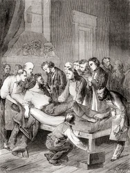 Den första offentliga demonstrationen av användningen av inhalerad eter som ett kirurgiskt bedövningsmedel 1846 av en amerikansk tandläkare, William Thomas Green Morton, från 