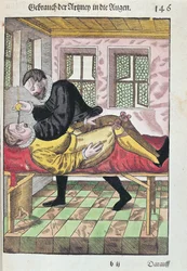 Eye Operation, från Ophthalmodouleia av Georg Bartisch (1535-1636) publicerad i Dresden 1583 (träblock i färg)