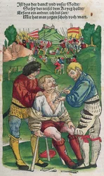 Att ta bort en pil, illustration från Feldtbuch der Wundartzney av Hans von Gersdorff, 1540