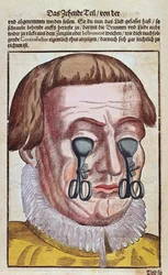 Treating an eye condition, från Ophthalmodouleia av Georg Bartisch (1535-1636) publicerad i Dresden 1583 (träblock i färg)