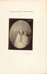 Fotografisk elektrofysiologi, figur 76
