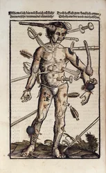XVIIIv The Wound Man, från 