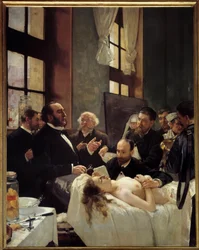 Dr Jules-Émile Péan (1830-1898) undervisar på Hôpital Saint-Louis om sin upptäckt av kärlavklämning. ”Före operationen”. Målning av Henri Gervex (1852-1929), 1887. H. 2,42 x 1,88 m, Paris, Musée d
