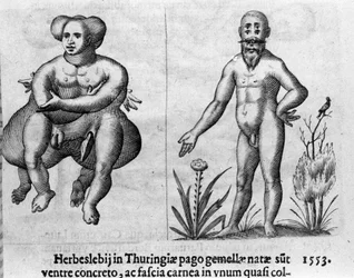Olika typer av mänskliga monster. Gravyr från "Monstrens natur, deras orsaker och skillnader" av Fortunio Whilei (1577-1656), italiensk vetenskapsman. 1646