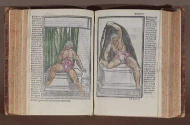 Kvinnlig anatomi, från kommentarer om världens anatomi med de största tilläggen, av Jacopo Berengario da Carpi (c.1460-c.1530) publicerad i Bologna, 1521 (träblock i färg)