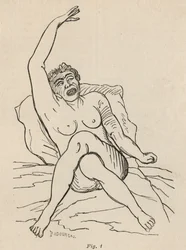 Hysterisk epilepsi, attack, vridningar, fig. 1 från 
