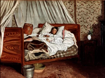Den improviserade ambulansen (Claude Monet sårad). Målning av Jean Frédéric Bazille (1841-1870)