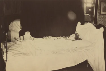 Dödsbäddsstudie av Adeline Grace Clogstoun,1872 (foto)