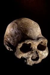 Homo erectus-skalle, tandlös, Dmanisi, Georgien Homo erectus-fyndplats