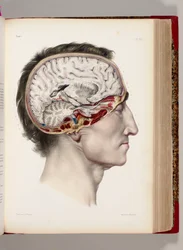 En handkolorerad litografi av ett dissekerat huvud i profil som visar hjärnan, ur "Traité complet de l’anatomie de l’homme, comprenant la médecine opératoire", 1831-54
