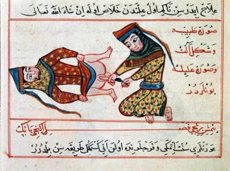 Medicin: operation av en hermafrodit. Miniatyr ur en avhandling om turkisk medicin av Sharaf al-din