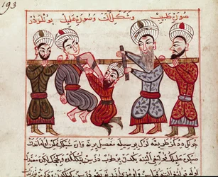 Medicin: ortopedisk intervention. Miniatyr tagen från en mjölkning av turkisk medicin av Charaf-ed-din (Charaf ed Din) (1404-1468) efter "" La Surgery Imperiale"" (Ms Sup Turk 693 fol. 193) 1466 Paris, B.N.