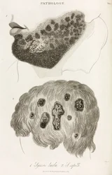 Dermatologi Hudsjukdomar