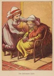 Det missbildade barnet (kolorerad gravyr)
