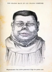Cretin 15 år, c1890