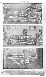 Illustration från Avicenna, 1556