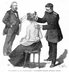Professor Bergmann injicerar en tuberkulospatient, 1891