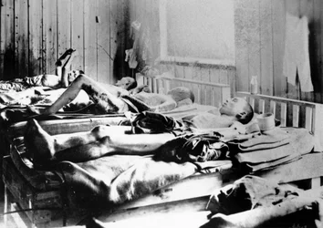 Överlevande från atombombsexplosionen i Hiroshima, Japan, 1945