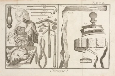Trepanation