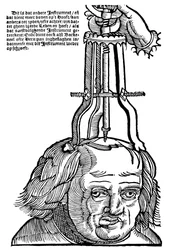 Trepanation, 1593