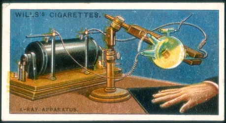 Röntgenapparat, 1915
