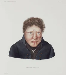 Sjukdomar, spetälska spetälska manlig, Island, tidigt 1800-tal