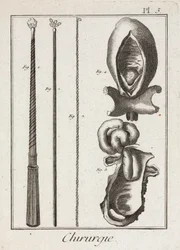 Utrustning, tidigmoderna kirurgiska instrument och diagram över kroppsdelar