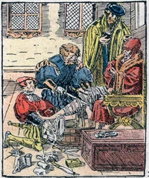 Amputation av ett ben på 1500-talet.