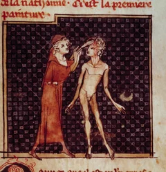 Anatomisk figur: Kirurgen snittar en patients panna. Miniatyr från manuskriptet "" Surgery" (Folio 8) skriven av Henri de Mondeville (kirurg hos Philippe Le Bel professor i anatomi)