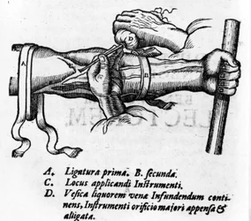 Anatomisk skiva: olika ligaturer. Work on the blood system av William Harvey (1578-1657), engelsk läkare. Han beskrev blodcirkulationen i kroppen genom venerna