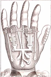 Konstgjord handprotes av den franska kirurgen Anatomist Ambroise Par